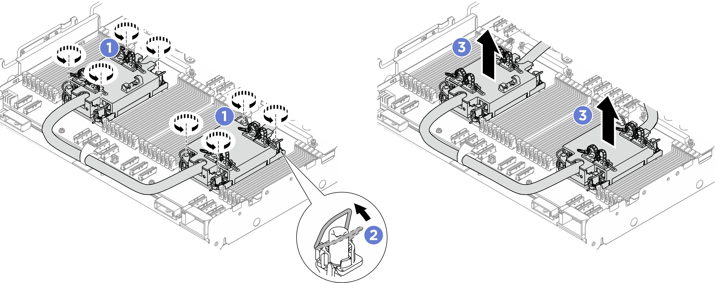 Removing the DWCM