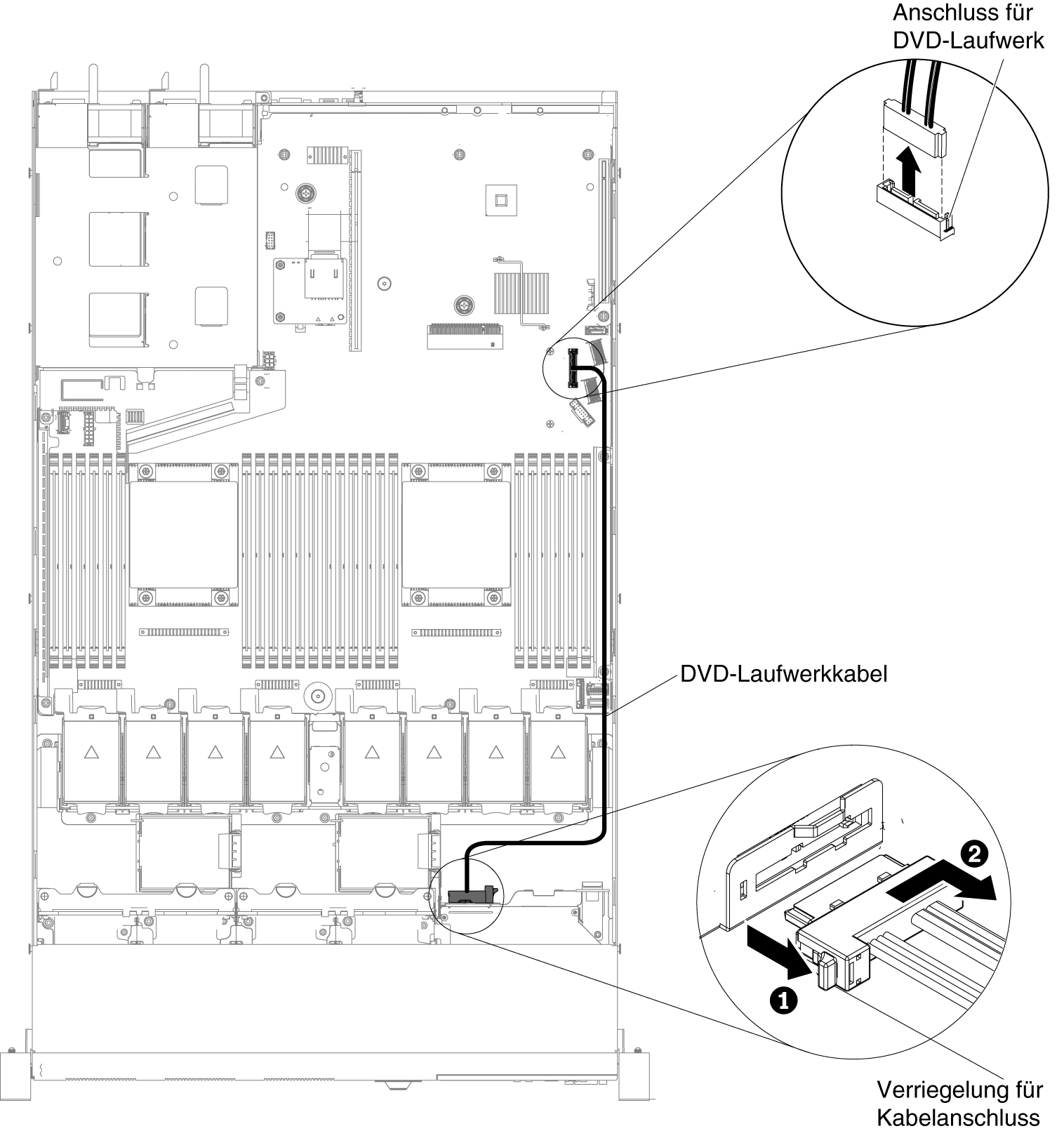 DVD-Laufwerkkabel für Servermodelle mit 2,5-Zoll-Festplattenlaufwerken entfernen